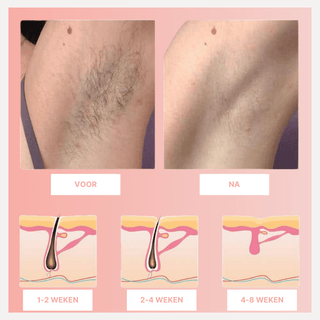 Silken | IPL Haarverwijderaar Vionelle